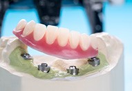 An implant denture on a table in Carmel