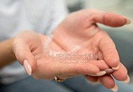Closeup of patient holding clear aligner