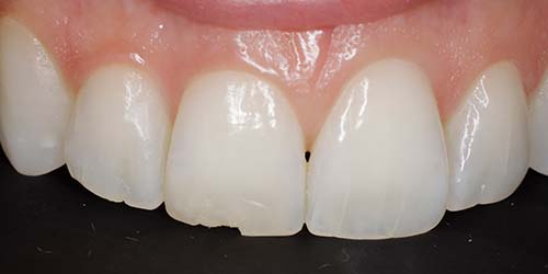 Before treatment