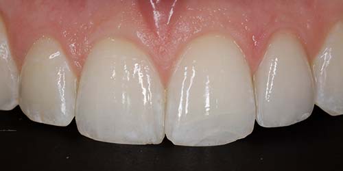 Before treatment