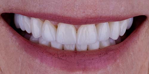 Before treatment