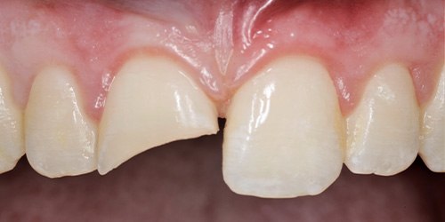 Before treatment