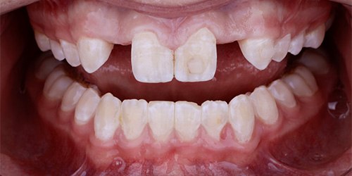Before treatment