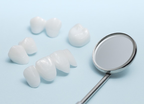 Different types of porcelain dental restorations