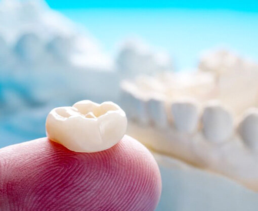 dental crown resting on persons finger