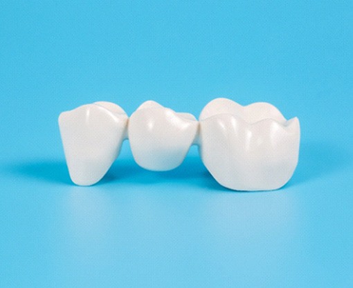 A sample dental bridge on a light blue background