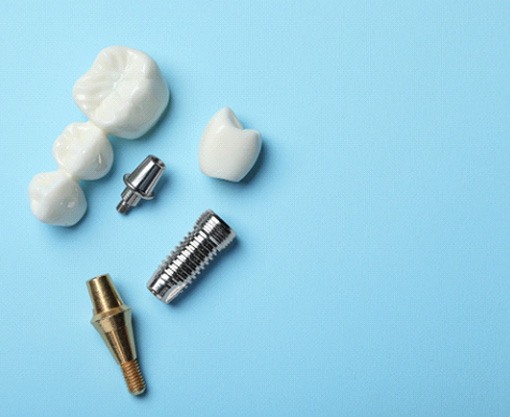 Traditional bridge and dental implant on a blue background