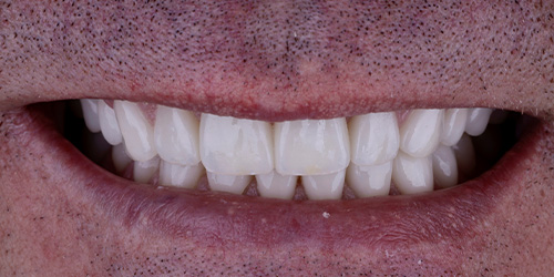 Before treatment
