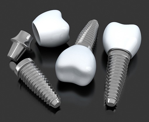 Dental implants lying on a table