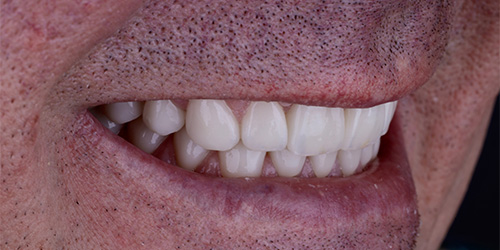 Before treatment