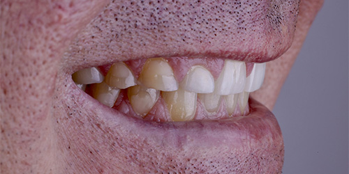 Before treatment