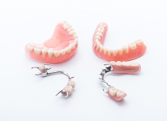 Four types of dentures