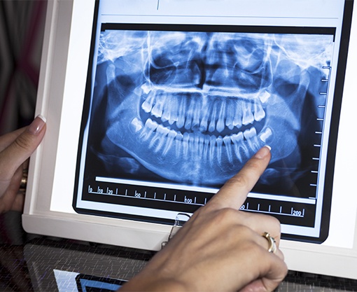 Panoramic dental x-rays on chairside computer