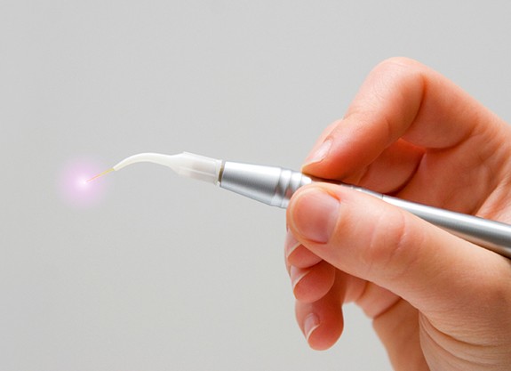 Hand holding laser dentistry tool