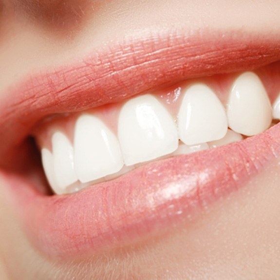 Close-up of smile after teeth whitening in Carmel, IN 