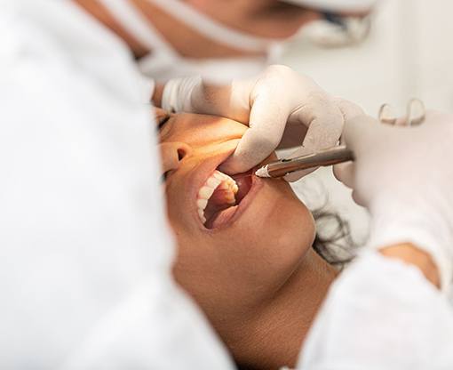 Two wisdom teeth laying next to dental instruments