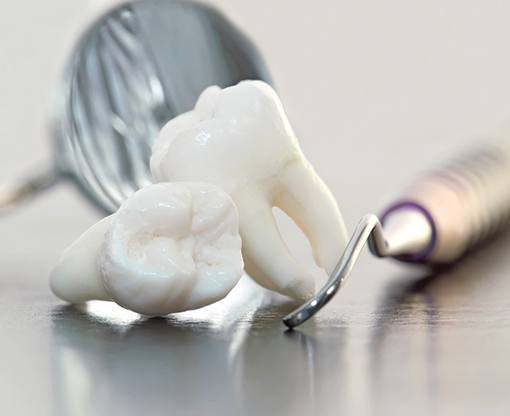 Two wisdom teeth laying next to dental instruments