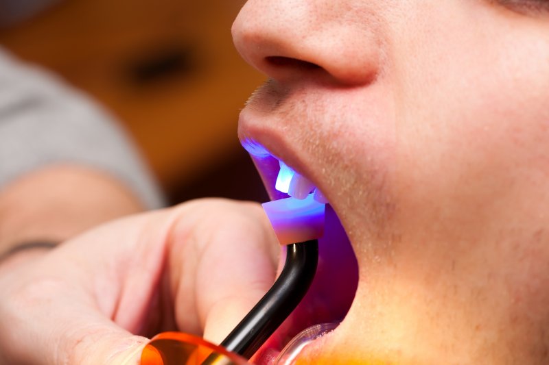 A dental patient receiving dental bonding in Carmel