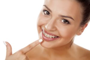 Woman with braces pointing to her teeth