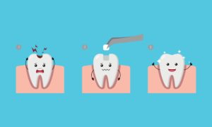 A simple illustration of a tooth with a cavity being filled then smiling about it