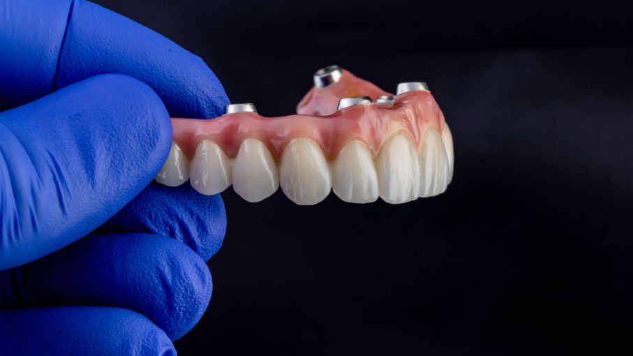 A hand holding an implant denture